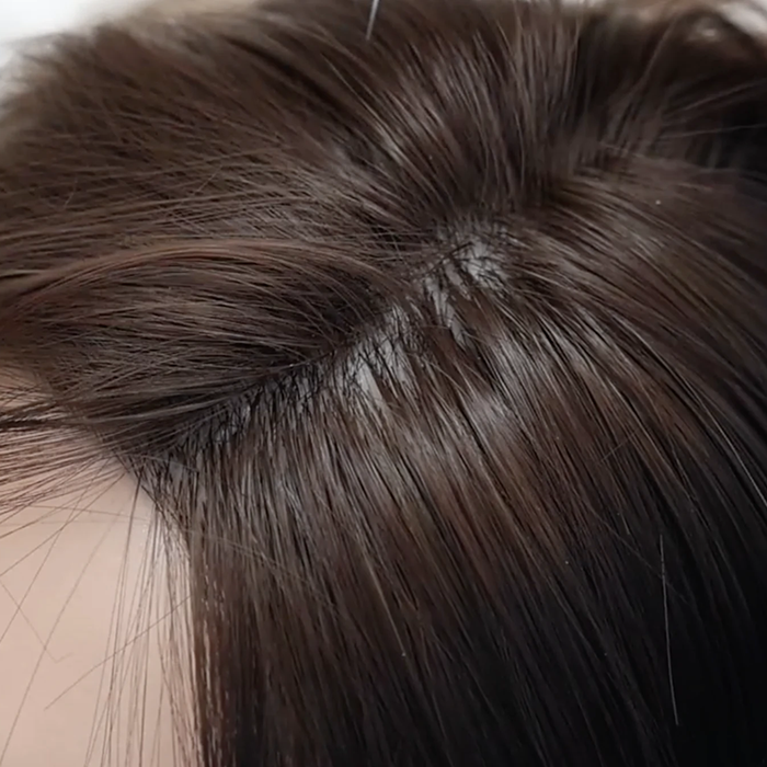 Implanted Hair